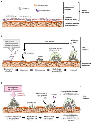 The Antibiofilm Role of Biotics Family in Vaginal Fungal Infections